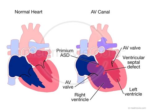 AV Canal – Medmovie.com