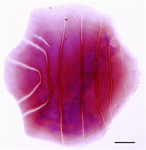 Stained scale removed from right side of mid-body (above anal fin) of... | Download Scientific ...