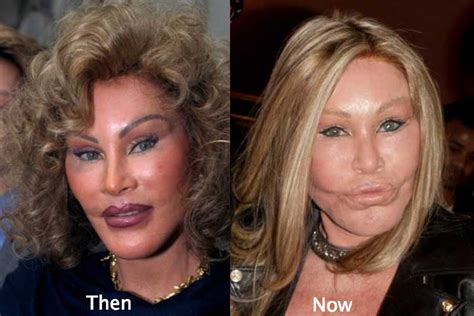 Jocelyn Wildenstein Plastic Surgery Awful Transformation