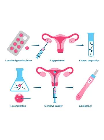 Test Tube Baby Treatment Process and Cost | Indira IVF