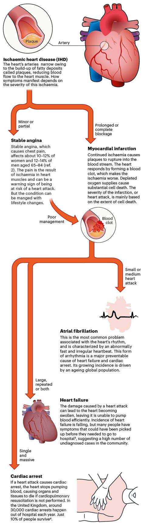 A graphical guide to ischaemic heart disease