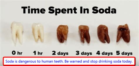 Acidic Foods And Drinks Bad For Teeth - Teeth Poster