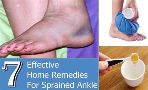 7 EFFECTIVE HOME REMEDIES FOR SPRAINED ANKLE! | Sprained ankle, Sprain ...