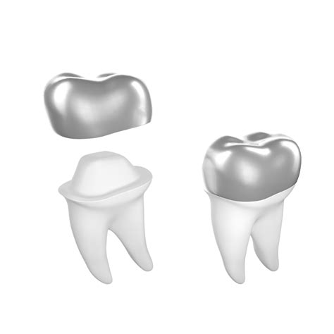 Stainless Steel Crowns for Cavities (Types and Cost)