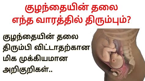 Baby head down position symptoms in tamil | thalai thirumpiyatharkana arigurigal |cephalic ...