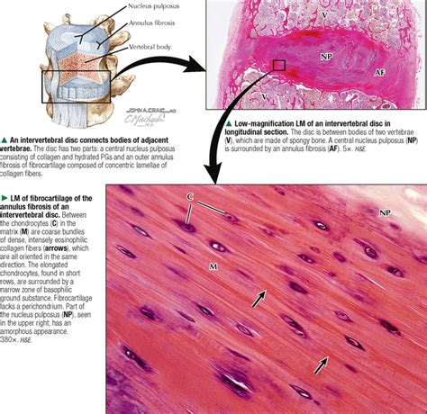 CARTILAGE AND BONE | Basicmedical Key