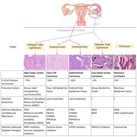 2. Histological Classification of Ovarian Carcinoma