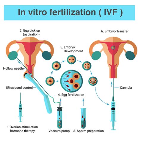 Difference between IVF and Test Tube Baby? | ChandigarhFirst.com