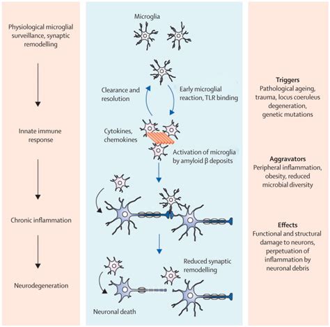 Neuroinflammation in Alzheimer's disease - The Lancet Neurology