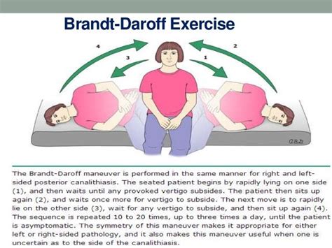Epley Manoeuvre Or Brandt Daroff Exercises – Online degrees