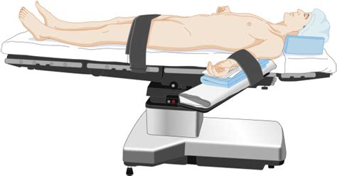 Patient Positioning and Associated Risks | Anesthesia Key