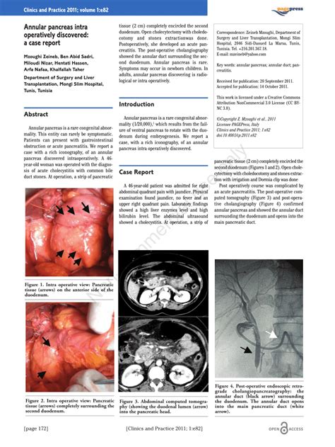 (PDF) Annular Pancreas Intra Operatively Discovered: A Case Report