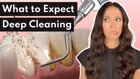 What To Expect From a DEEP Cleaning at the Dentist - Dental Clinic