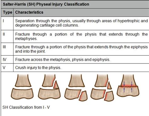 Pediatric Fractures | Learn Pediatrics