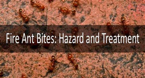 Best Fire Ant Bites Treatment: What to Do if You Are Bitten