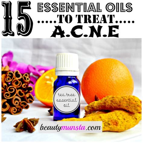 List of Best Essential Oils for Acne & How to Use - beautymunsta