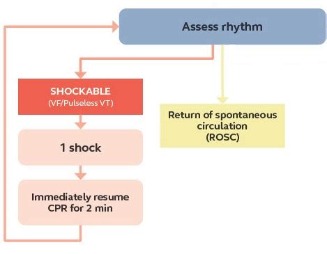 Shockable Rhythm Arm of The ALS Algorithm - RCEMLearning India