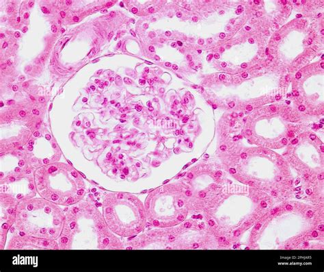 Kidney glomerulus, light micrograph Stock Photo - Alamy