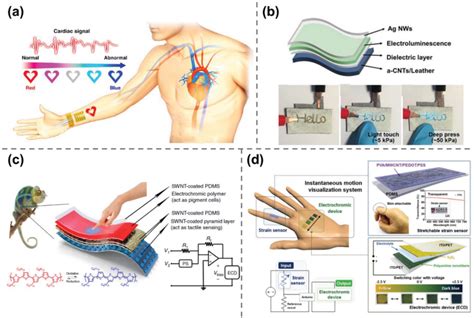 a) Schematic illustration of a wearable ECG real‐time monitor ...