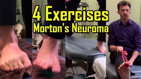 Morton's Neuroma Treatment Exercises - Quotes Trendy