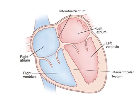 INTERVENTRICULAR SEPTUM- band of tissue that separates right and left ...