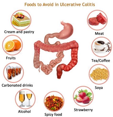 diet-and-home-remedies-for-ulcerative-colitis - Theayurveda