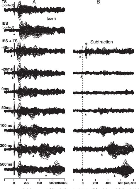 Figure 1 from Temporal analysis of cortical mechanisms for pain relief ...