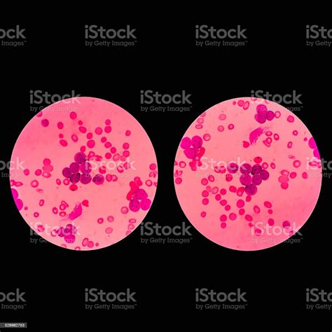 Blood Smear Under Microscope Stock Photo - Download Image Now ...