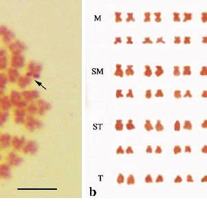 Results of the silver staining of (a) metaphase chromosome spreads and... | Download Scientific ...