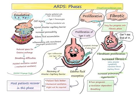 Acute Respiratory Distress Syndrome (ARDS) - Creative Med Doses