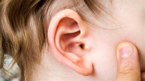 Ear wax: children & teens | Raising Children Network