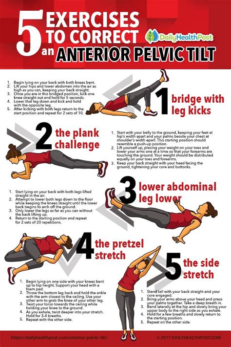 Lateral Pelvic Tilt Correction Exercises