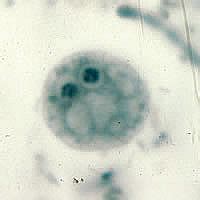 Dientamoeba Fragilis Troph