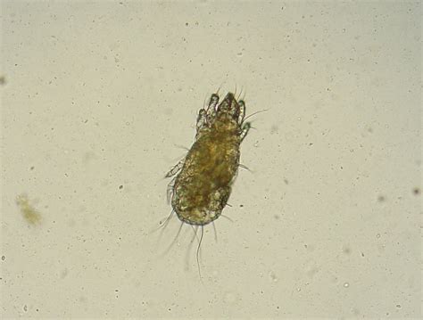 File:Grain mite 1.JPG - Wikimedia Commons