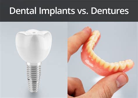 Dental Implants vs Dentures – Boston, MA - Boston Prosthodontics