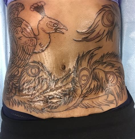 Outline done. Tummy tuck scar cover up! #tummytuck #pheonix #lovemyink ...