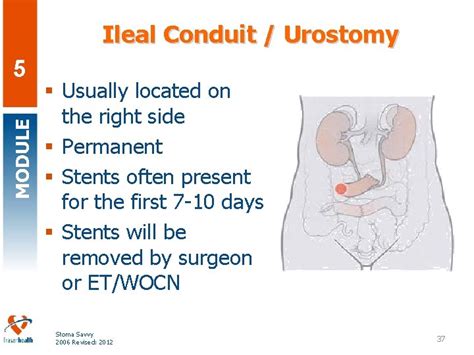 Stoma Savvy Fraser Health Regional Wound Education Regional