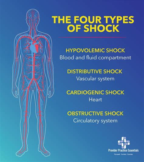 Types Of Shock Treatment