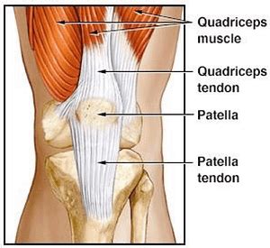 Patellar Dislocations: Signs, Symptoms and Treatments - High Mountain ...