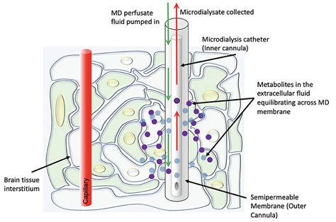 Frontiers | Cerebral microdialysis and glucopenia in traumatic brain ...