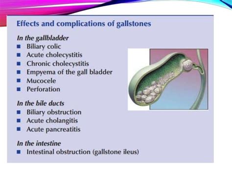 Gallstones and it's Complications