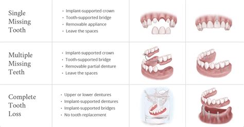 Treatment Options | Oral Surgery Partners