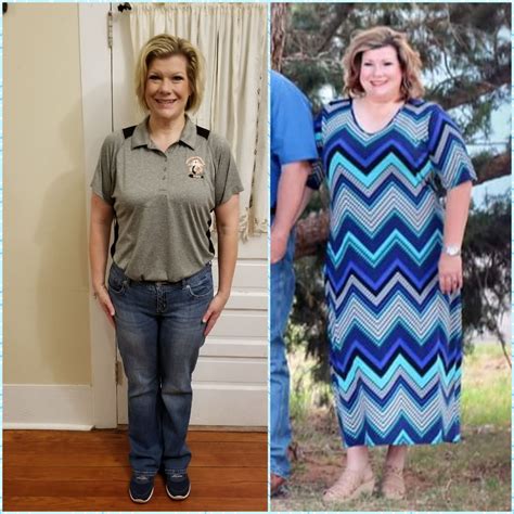 Weight Loss Before and After: Christine's 100 Pound Weight Loss Story