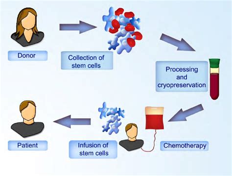 Allogeneic stem cell transplantation. Hematopoietic stem cells are... | Download Scientific Diagram