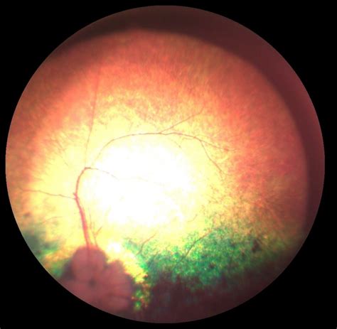 Blindsight? | Veterinary ophthalmology