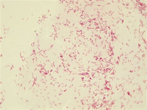 Micrograph Escherichia coli Gram stain 1000x p000007 | OER Commons