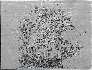 Direct Detection Methods Mxv - Susceptibility Testing