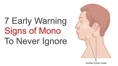 Symptoms of mono - julusunny