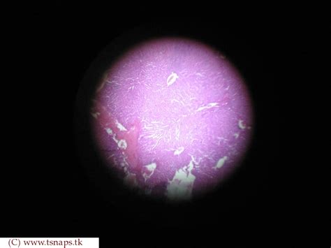 Histology Slides Database: human liver histology slides