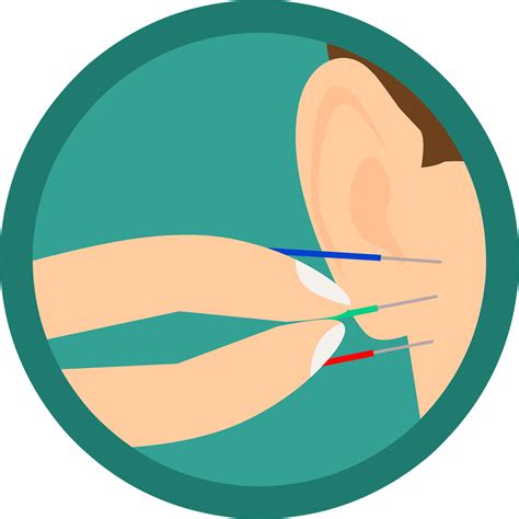 Download Acupuncture, Ear, Needles. Royalty-Free Vector Graphic - Pixabay